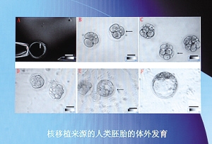 �Զ�����ĺ���ֲ��Դ��������̥�����ⷢ��ͼ